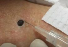 “Zeni je ovo stojalo na ledjima godinama- Kada je doktorica uzela spricu i bocnula svi su zaledjeni ostali.” SNIMAK pregledan 33 miliona puta “Zeni je ovo stojalo na ledjima godinama- Kada je doktorica uzela spricu i bocnula svi su zaledjeni ostali.” SNIMAK pregledan 33 miliona puta - featured image