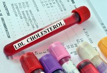 Stručnjaci tvrde da 1 promena čisti organizam od lošeg holesterola