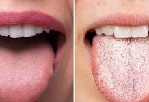 ODMAH POGLEDAJTE DA LI I VI IMATE OVO NA JEZIKU: To je znak da vam se dešavaju ove dvije stvari, PRVA VAM SE NIKAKO NEĆE DOPASTI