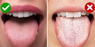 ODMAH POGLEDAJTE DA LI I VI IMATE OVO NA JEZIKU: To je znak da vam se dešavaju ove dvije stvari, PRVA VAM SE NIKAKO NEĆE DOPASTI