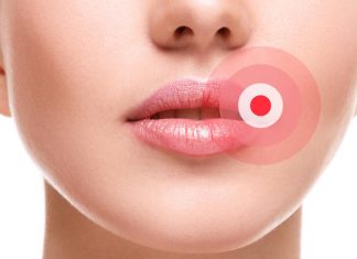 Ako ste ga ikada imali OVO u ustima, trebali bi znati šta je u pitanju, i kako da se toga riješite..