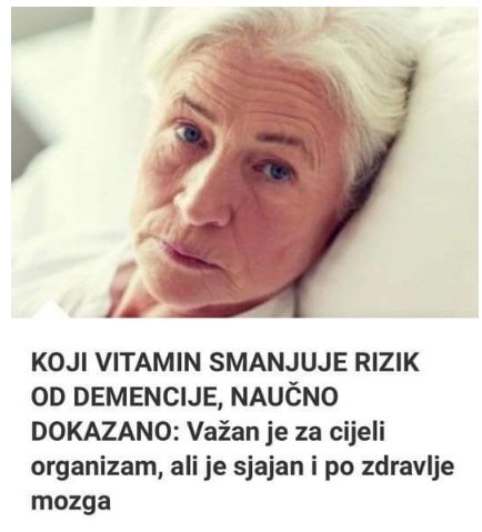 Ovaj vitamin smanjuje rizik od demencije: Važan je za cijeli organizam a posebno za zdravlje mozga! - featured image Ovaj vitamin smanjuje rizik od demencije: Važan je za cijeli organizam a posebno za zdravlje mozga! - featured image