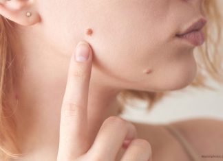 Iz mladeža vam rastu dlačice? Evo što to znači i kada biti na oprezu