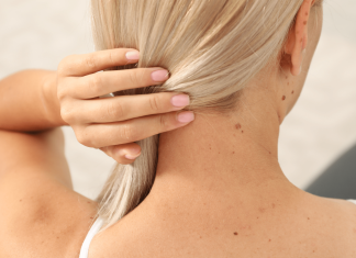 OTKRIJTE ISTINU Šta znači ako imate mladež na licu, ruci ili stopalu