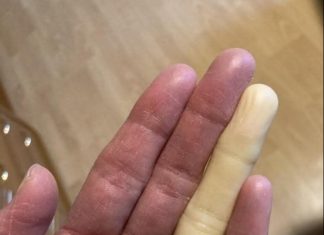 Ovo su posljedice spavanja sa…