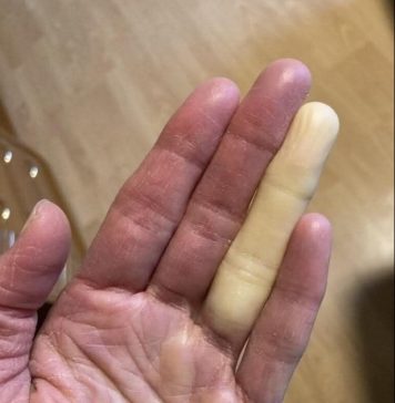 Ovo su posljedice spavanja sa…