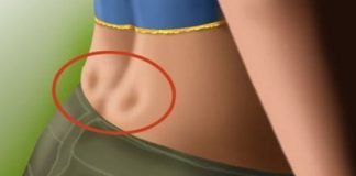 lMATE Ll 0VE 2 RUPlCE NA LEĐlMA: To znači da nemate…