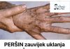 PERŠIN Zauvijek Uklanja STARAČKE MRLJE! Ovo Morate Napraviti… PERŠIN Zauvijek Uklanja STARAČKE MRLJE! Ovo Morate Napraviti… - featured image