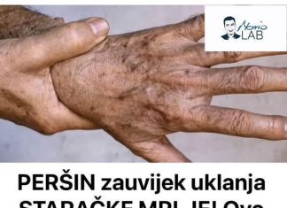 PERŠIN Zauvijek Uklanja STARAČKE MRLJE! Ovo Morate Napraviti… PERŠIN Zauvijek Uklanja STARAČKE MRLJE! Ovo Morate Napraviti… - featured image