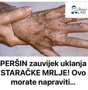 PERŠIN Zauvijek Uklanja STARAČKE MRLJE! Ovo Morate Napraviti… PERŠIN Zauvijek Uklanja STARAČKE MRLJE! Ovo Morate Napraviti… - featured image