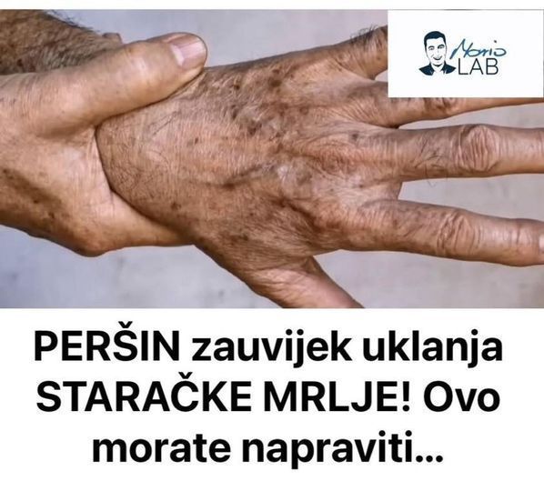 PERŠIN Zauvijek Uklanja STARAČKE MRLJE! Ovo Morate Napraviti… - featured image PERŠIN Zauvijek Uklanja STARAČKE MRLJE! Ovo Morate Napraviti… - featured image