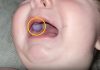 Majka je primetila nešto neobično u ustima svog devetomesečnog sina i odmah je otišla kod lekara — otkriće lekara bilo je iznenađujuće. Majka je primetila nešto neobično u ustima svog devetomesečnog sina i odmah je otišla kod lekara — otkriće lekara bilo je iznenađujuće. - featured image